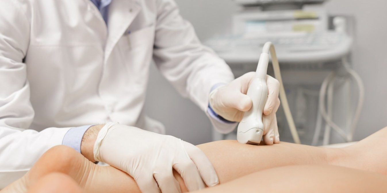 Varicenter, tratamiento de varices en Alicante