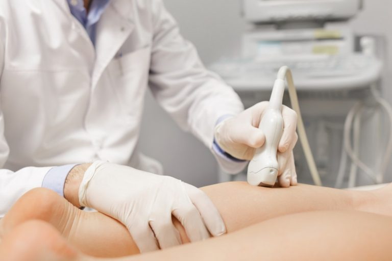 Varicenter, tratamiento de varices en Alicante